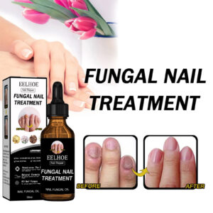 nail repair solution